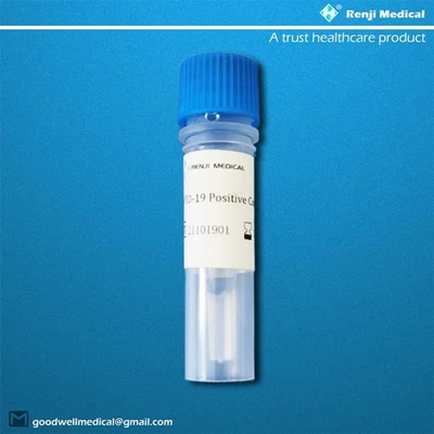 Kit Tes Virus Corona Novel COVID-19, pengujian kapasitas tinggi, persetujuan YBTC MA