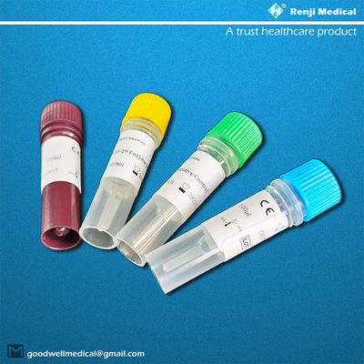 CE Novel Coronavirus Antigen Test Kit Hasil lengkap 40-90 menit