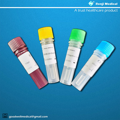 Kit Pengujian Asam Nukleat Penyelidik Fluoresensi, RT-PCR Novel Coronavirus Test Rapid